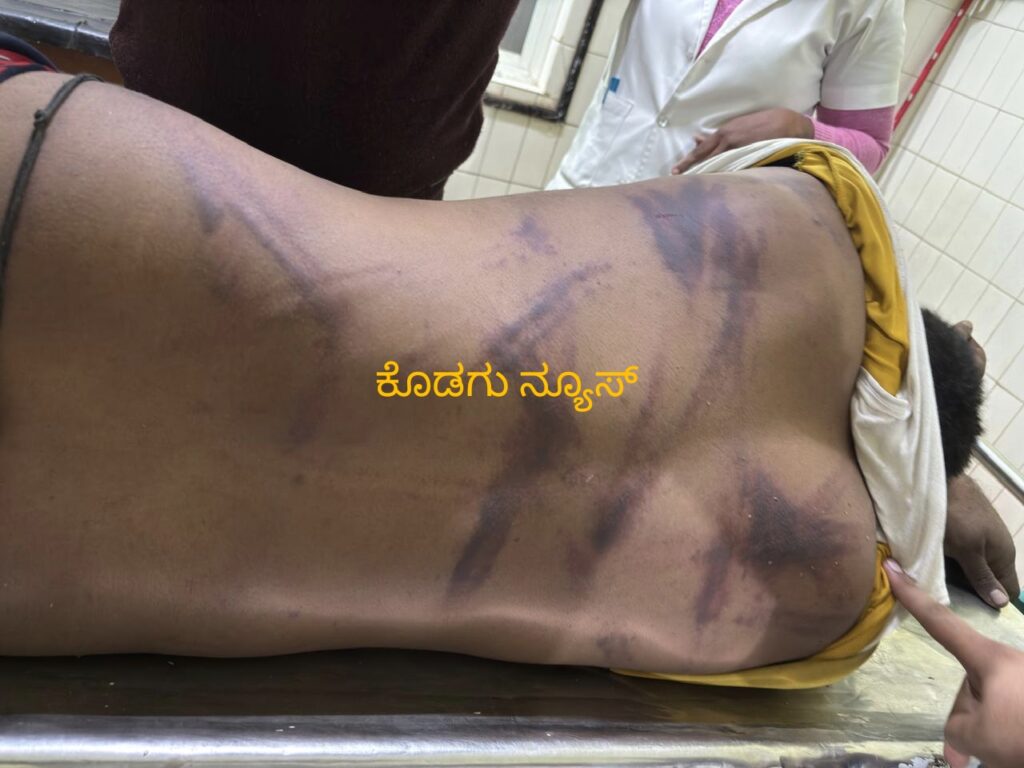 ಗೋಣಿಕೊಪ್ಪದಲ್ಲಿ ಹೊಸವರ್ಷದಂದೆ ಅಮಾನವೀಯ ಘಟನೆ